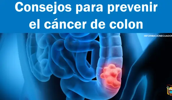 Consejos para prevenir el cáncer de colon