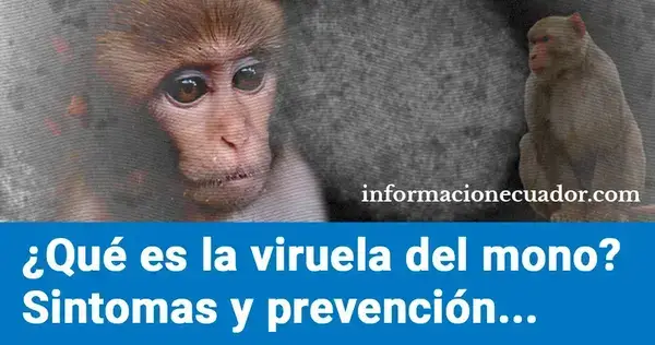 ¿Qué es la viruela del mono Síntomas y como prevenirlo